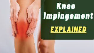 Knee Impingement explained by Physical Therapists  Front of Knee Pain [upl. by Tergram]