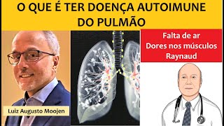 O que é ter doença autoimune do pulmão Fibrose pulmonar [upl. by Marianne485]