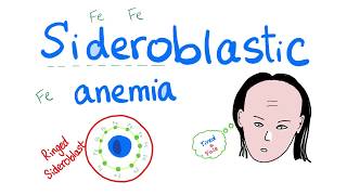 Sideroblastic Anemia [upl. by Mian829]