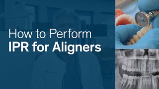 How to Perform IPR for Reveal® Clear Aligners [upl. by Ahsaret]