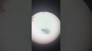 Ear mites of cats  Veterinary Medicine  Feline Medicine [upl. by Ardnuhs]