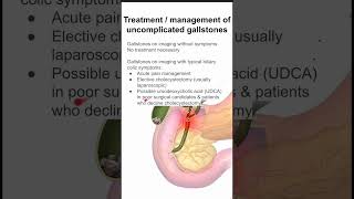 Treatment  management of uncomplicated gallstones [upl. by Llenoj174]