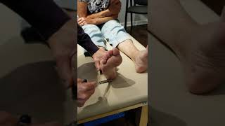 Video 537 Plantar Reflex Test [upl. by Lucier]