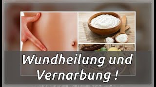 3 wunderbare Pflanzen zur besseren Wundheilung und Vernarbung [upl. by Corbie]