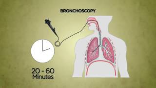 Bronchoscopy [upl. by Etnohc]