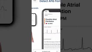 YOUR PORTABLE EKG COMPANION  KARDIAMOBILE 1  AMAZON FINDS ❤️ [upl. by Acemahs]