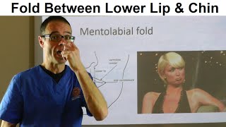 Importance of a Fold Between Lower Lip amp Chin Muscle Mentolabial Fold by Dr Mike Mew [upl. by Aivull]