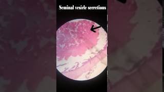 Seminal Vesicle Histology [upl. by Dric]