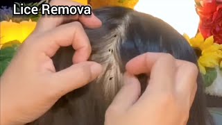 ASMR You have bad lice problem Sis will help to remove it  No Talking 😴💤🥱 [upl. by Eleen]