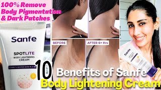 How to use Body Whitening Brightening cream✨ Benefits of Sanfe Spotlite Body Lightening cream review [upl. by Akcire]