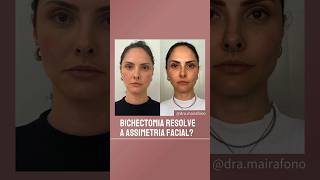 Bichectomia resolve mesmo a assimetria facial bichectomia estetica [upl. by Schuman]