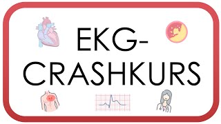 EKG Crashkurs  Auswerten in unter 10 Minuten AVBlock Vorhofflimmern STEMI Perikarditis [upl. by Arihsay]