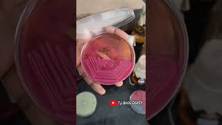 Macconkey agar biologycultureplate microbiology science MAC tjbiologist medicalfield love [upl. by Moth771]