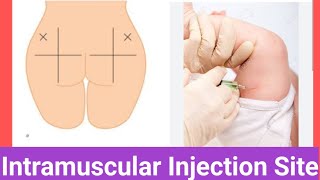 Intramuscular Injection Sites [upl. by Anidem]