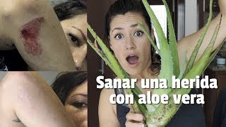 Sanar una herida de manera natural Aloe vera [upl. by Assyla]