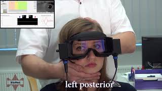 vHIT testing the anterior and posterior SCC [upl. by Odnalor]