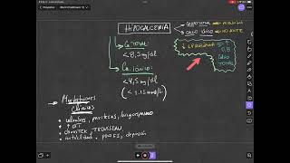 HIPOCALCEMIA Dr Héctor Ortega [upl. by Ycniuq]