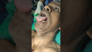 clinical demonstration of thyroglossal cyst [upl. by Arukas]