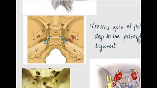 Abducen nerve6th cranial nerveCN VIOphthalmology Revision [upl. by Hadihahs]