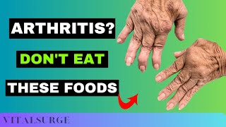 9 Foods To Avoid for Arthritis Stop Now [upl. by Par]