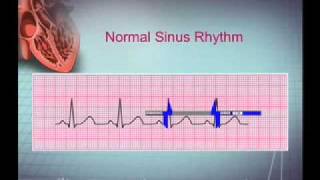 Intro EKG Interpretation Part 1 [upl. by Adalie]