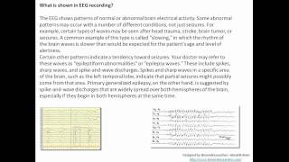 Understanding EEG Part 6Machine used in EEG diagnostic application signal recorded clinical use [upl. by Ailana45]