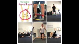 Correcting Knee Valgus [upl. by Tiphani38]