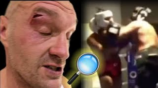 BREAKING NEWS ❗ FOOTAGE OF TYSON FURYS ALLEGED CUT EXAMINATED COUNTERPUNCHED 🚨🤔🛑 [upl. by Alisa]