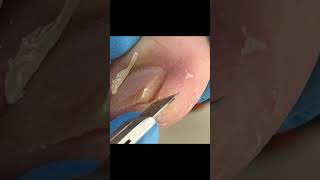 Satisfying Pedicure Video pedicure toenails [upl. by Dudley173]