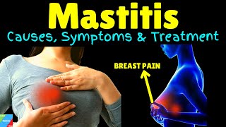 Mastitis  Breast Infection  Symptoms Causes Treatment Prevention [upl. by Curnin]