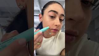 Easy Dermatologist Approved Acne Solution  Clinique Acne Solutions Emergency Touch Stick [upl. by Leahsim]