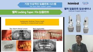 Subcrestal Placement  Biologic integration and implant design [upl. by Nniw]