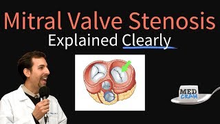 Mitral Valve Stenosis Explained Clearly  Pathophysiology Symptoms Treatment [upl. by Allehc]