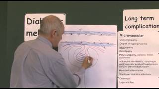 Diabetes 19 Microvascular Complications [upl. by Laiceps]