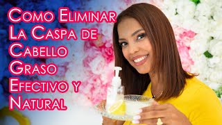 Como Eliminar La Caspa de Cabello Graso Remedio Natural Efectivo y Economico [upl. by Guimar962]