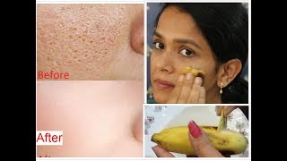 How to close Large amp Open pores100 safe and natural  beyoudefining  Tamil youtuber [upl. by Nie]