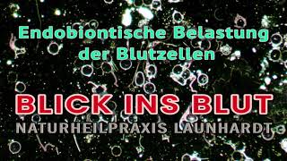 Blick ins Blut  Endobiontische Belastung der Blutzellen [upl. by Naman]