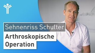 Sehnenriss Schulter OP Operation der Rotatorenmanschette zur Behandlung der Schulterschmerzen [upl. by Ytsud]