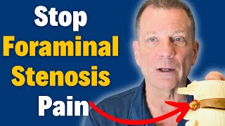 7 Steps to Beat Foraminal Stenosis Without Surgery amp Relieve Nerve Pain  Dr John Zielonka [upl. by Hyacinthie826]