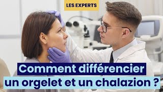 Comment différencier un orgelet et un chalazion  👀 [upl. by Meredi837]