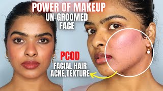 Real POWER of MAKEUP on UNGROOMED SKIN  Makeup on facial hair acne marks texture Shalini Mandal [upl. by Yort131]