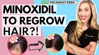 Minoxidil For Hair Loss  Everything you need to know [upl. by Fiester688]