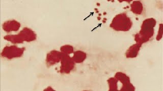 Medical Index  Aerobic Gram Neg Diplococci and Coccobacilli [upl. by Aicinod360]