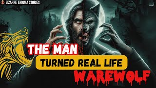 The man turned real life werewolf  werewolf  2024 Werewolf Syndrome werewolf by night [upl. by Letnohc891]