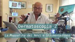 mappatura dei nevi strumentazione [upl. by Aldred]