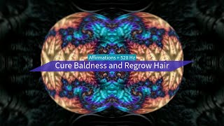 Cure Baldness and Regrow Hair Affirmations  528 Hz [upl. by Averell]