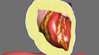 PERICARDIAL EFFUSION vs CARDIAC TAMPONADE  EXPLAINED IN 5 MINUTES Becks Triad Causes Diagnosis [upl. by Dlopoel]