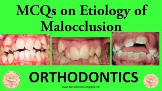 MCQs in Orthodontics  Etiology of Malocclusion  Dentosphere [upl. by Morris823]