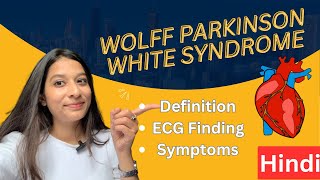 WolffParkinsonWhite WPW Syndrome in Hindi  ECG findings Diagnosis Treatment [upl. by Luapleahcim]