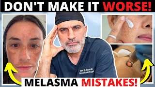 Melasma mistakes that can ruin your skin and make hyperpigmentation worse [upl. by Attezi726]